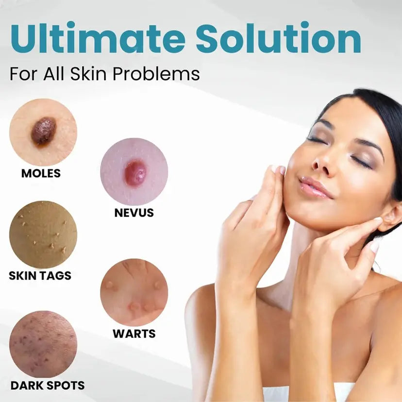 Non-Invasive Mole and Wart Removal Laser Pen