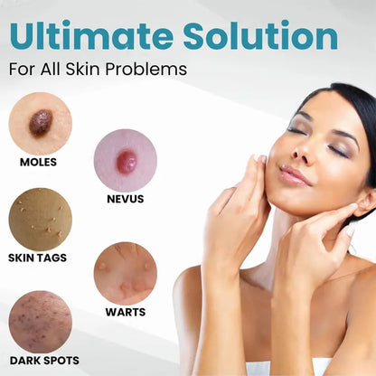 Non-Invasive Mole and Wart Removal Laser Pen